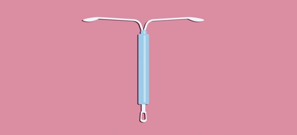 Getting an IUD – What You Need to Know